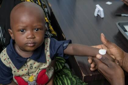 Expertos consideran que este método podría ayudar a erradicar el sarampión y la rubeóla en el mundo. Foto: La Nación