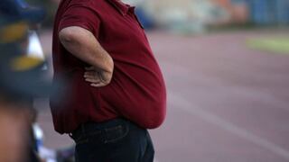 FAO: La obesidad mata a más gente que el crimen organizado en Perú