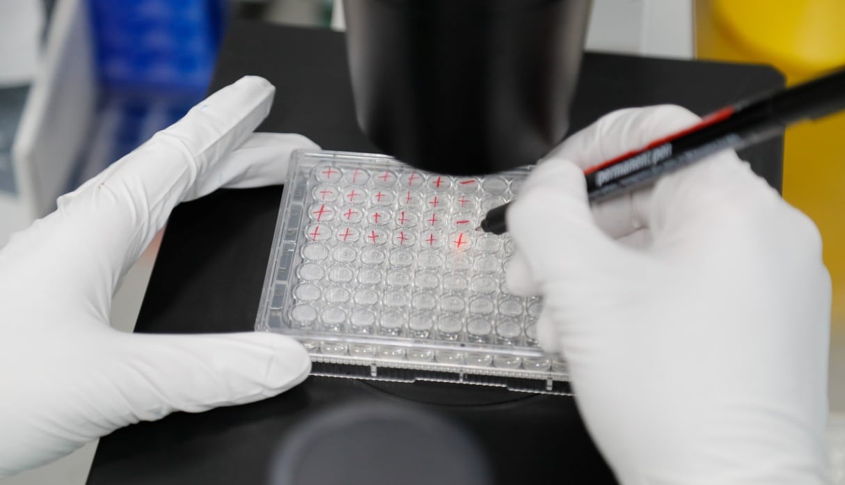 Cellgenic inició actividad comercial en Perú con productos vinculados a la medicina regenerativa. (Foto: REUTERS).