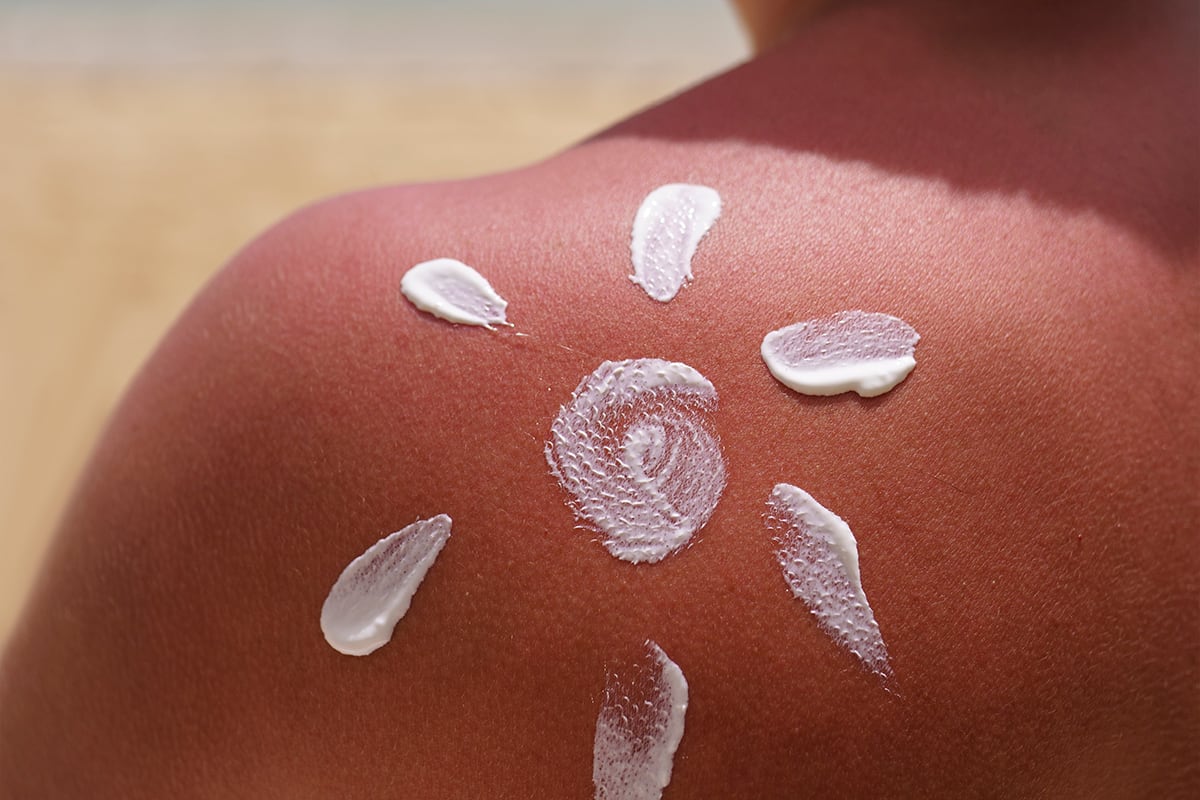 Palmera prevé crecer alrededor de 60% en venta de bloqueadores solares este y el próximo año. (Foto: @Freepcik)