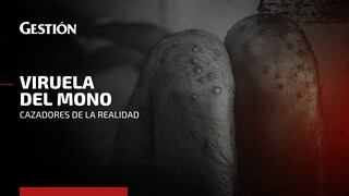 Viruela del mono: el caso de un paciente que contrajo la enfermedad y es atendido en el Hospital Cayetano Heredia