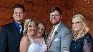 El contundente mensaje de las siamesas Abby y Brittany Hensel a sus críticos tras la boda de una de ellas