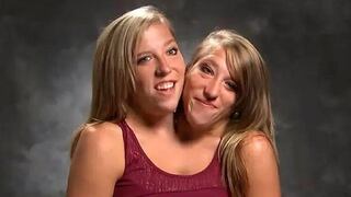 La gemela siamesa Abby Hensel hace frente al acoso mediático tras su boda en secreto