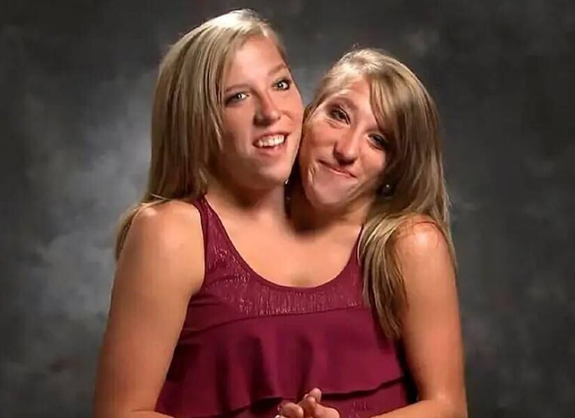 VIRAL | Las siamesas Hensel reaparecen tras la boda. (Instagram)