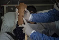 OMS: expansión de mpox requiere respuesta unificada, pero sin entrar en pánico