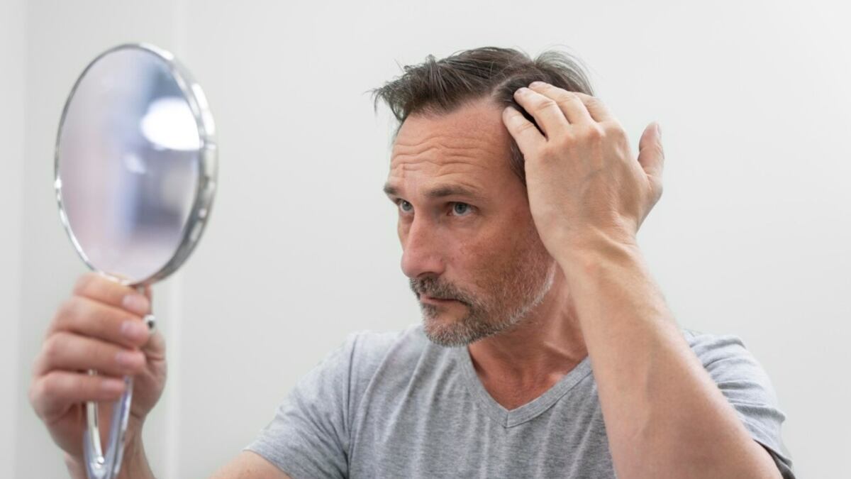 Por qué se cae el cabello y cuánto tiempo debes esperar para ver resultados en un tratamiento