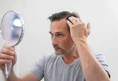 Por qué se cae el cabello y cuánto tiempo debes esperar para ver resultados en un tratamiento