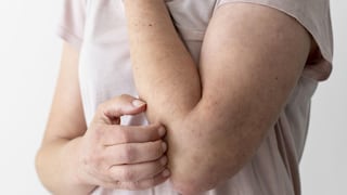 Nuevos casos de sarampión en un centro de ICE en Texas: la contundente advertencia de un reconocido médico que genera alerta