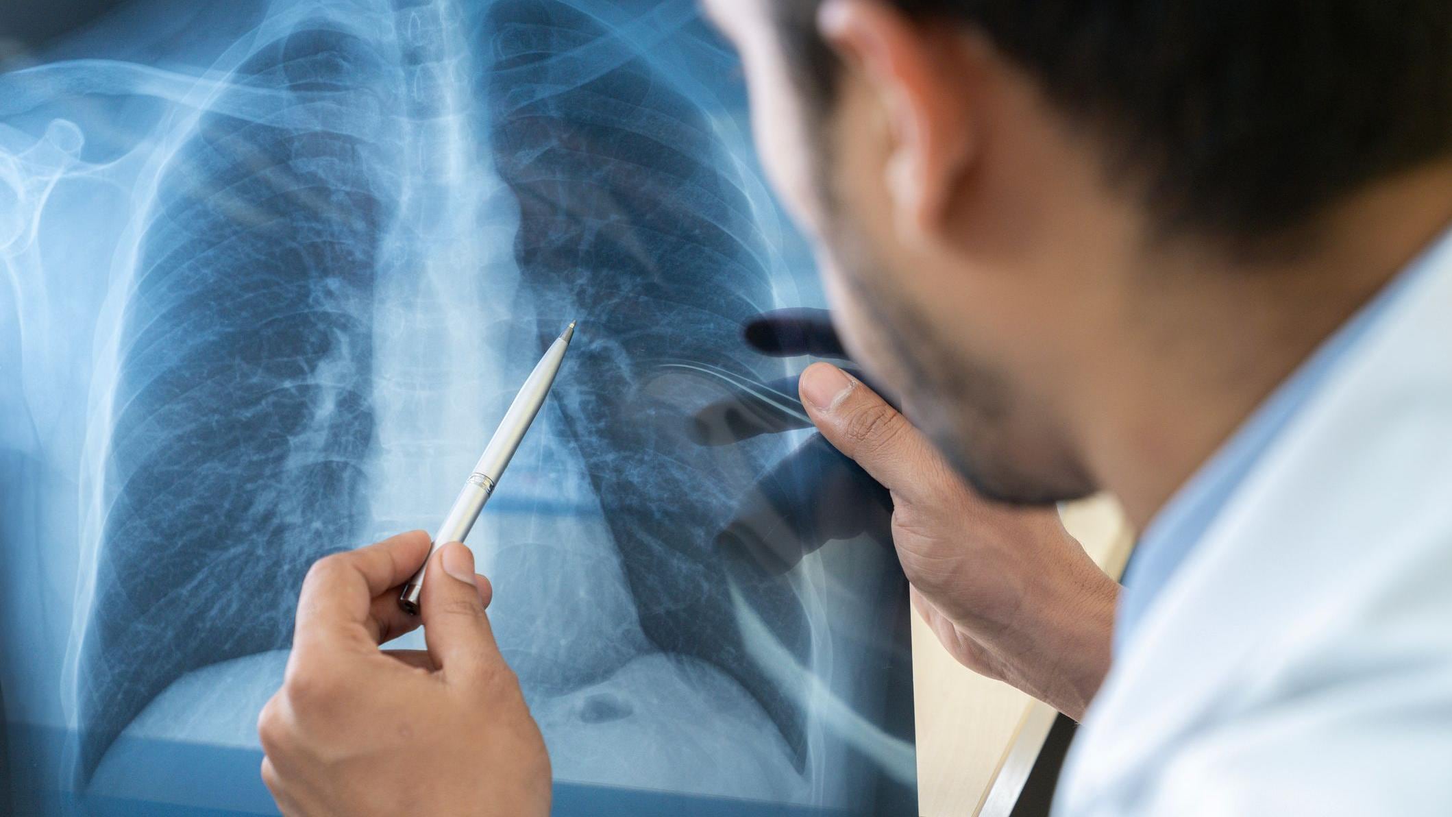 Nanox anunció su ingreso al mercado peruano mediante un acuerdo de distribución exclusiva con Top Med para desplegar sistemas de diagnóstico por imágenes. (Foto referencial)