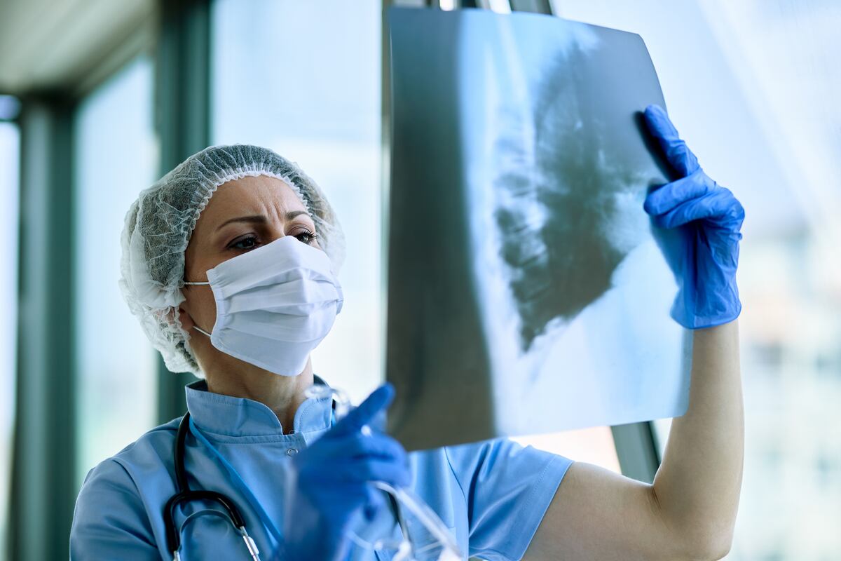 La preocupación es si esta variante, “así como sus descendientes, incluido JN.1, tendrán o no una mayor tendencia a infectar las células epiteliales pulmonares humanas de forma similar al virus parental que lanzó la pandemia en 2020″, señaló. (Foto: archivo)
