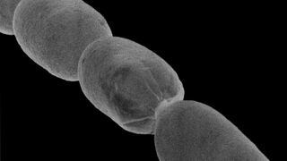 La genética recorre miles de años en busca del elusivo origen de la peste
