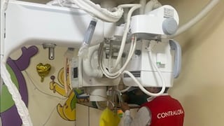 Hospital del Niño de Breña: detectan más de 100 equipos biomédicos inoperativos