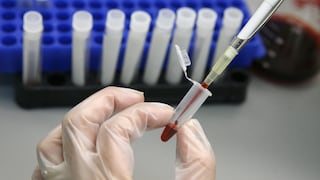 Desarrollan un nuevo tratamiento de acción prolongada para el VIH