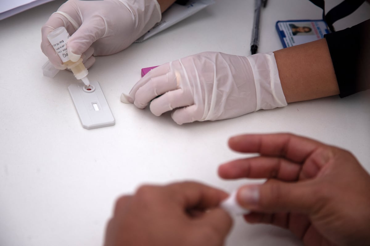 Un trasplante de células madre es un procedimiento “muy agresivo” indicado en cánceres de sangre y no aplicable a la población en general con VIH. (Foto: CLAUDIO REYES / AFP)