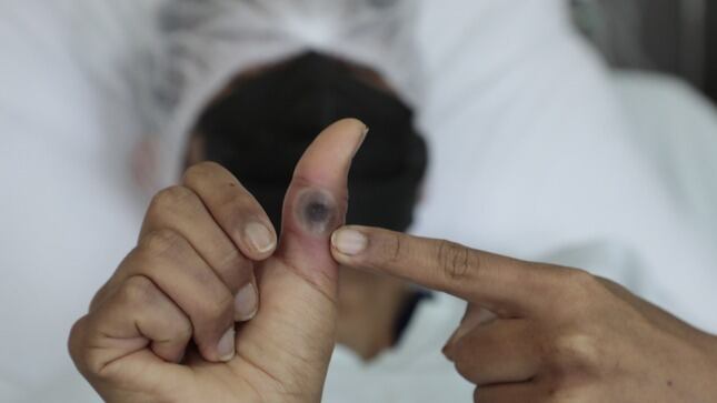 Viruela del mono. (Foto: Difusión)