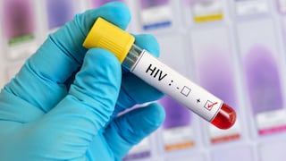 Nuevos avances hacia una vacuna eficaz frente al VIH gracias a estrategia secuencial