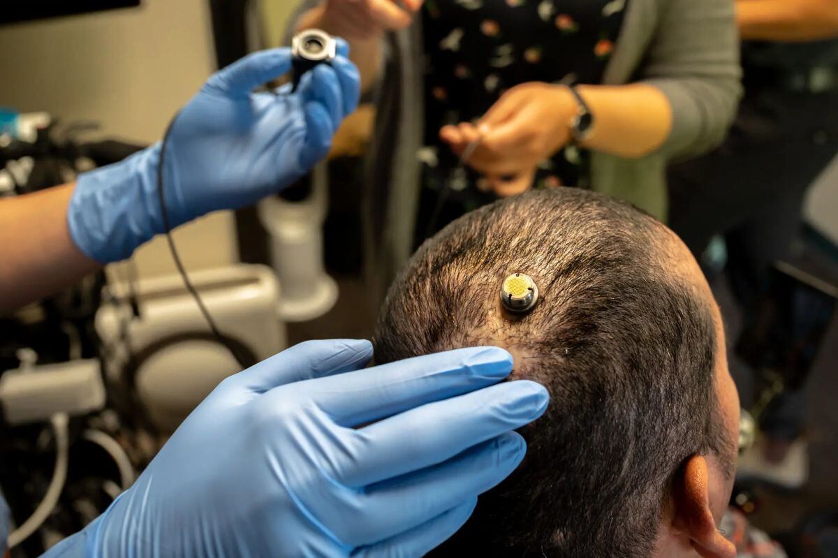 Este sector en pleno auge, donde dominan las empresas Synchron y Neuralink, de Elon Musk. (Foto: The New York Times)