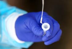 COVID: qué diferencias hay entre una PCR y la prueba de antígenos