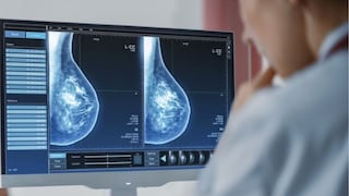 Perú aprueba reglamento para la prevención y atención del cáncer en mujeres