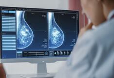 Perú aprueba reglamento para la prevención y atención del cáncer en mujeres