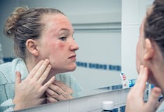 ¿Un cosmético te hizo daño? Indecopi define cuándo la empresa es responsable