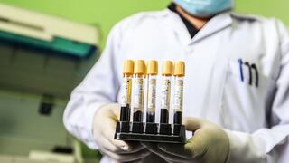 Asociación de Clínicas pide al Minsa derogar o modificar de norma de bancos de sangre