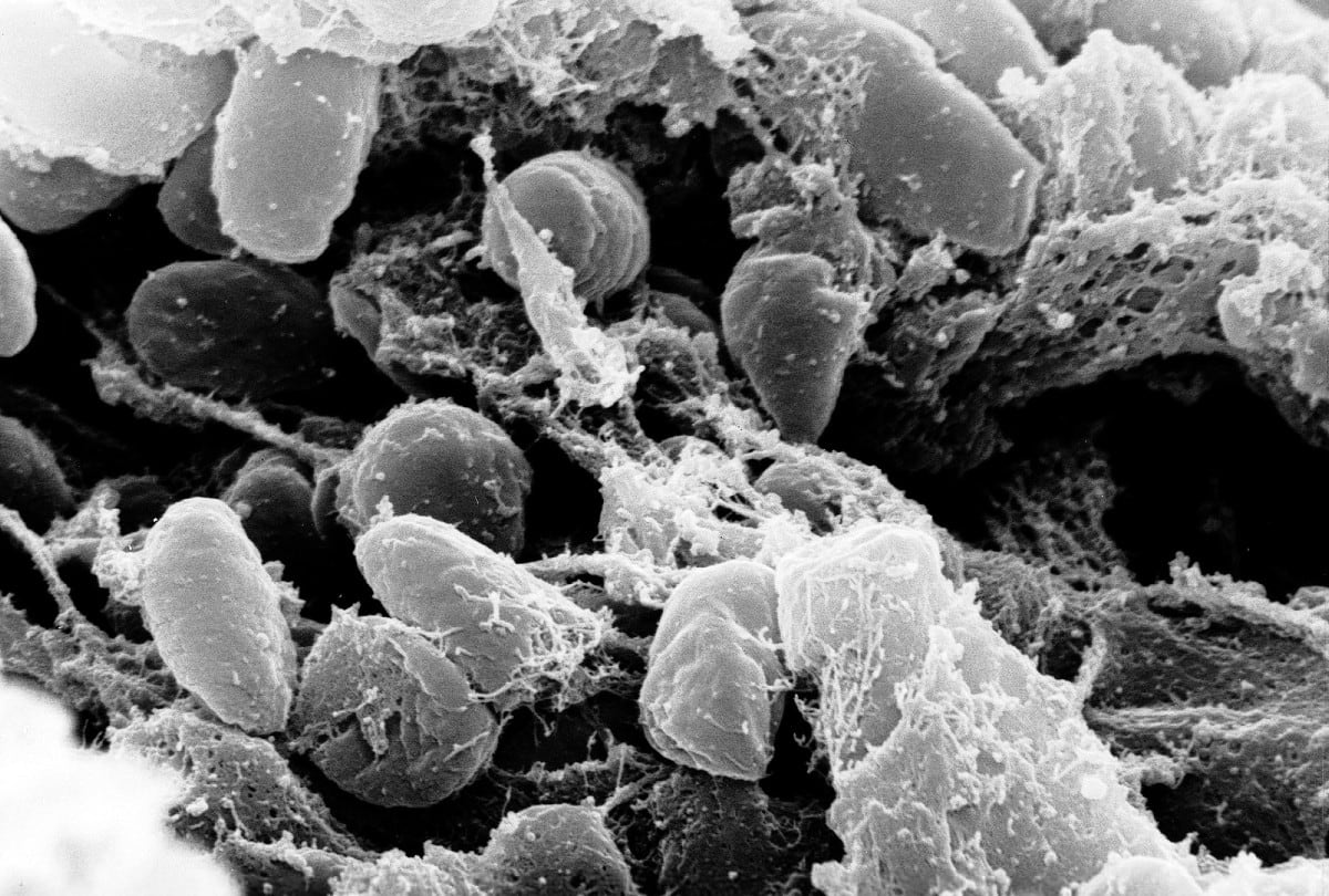 Microfotografía electrónica de barrido que muestra una masa de bacterias Yersinia pestis (la causante de la peste bubónica) en el intestino anterior del vector de la pulga. | Crédito: Rocky Mountain Laboratories, NIAID, NIH