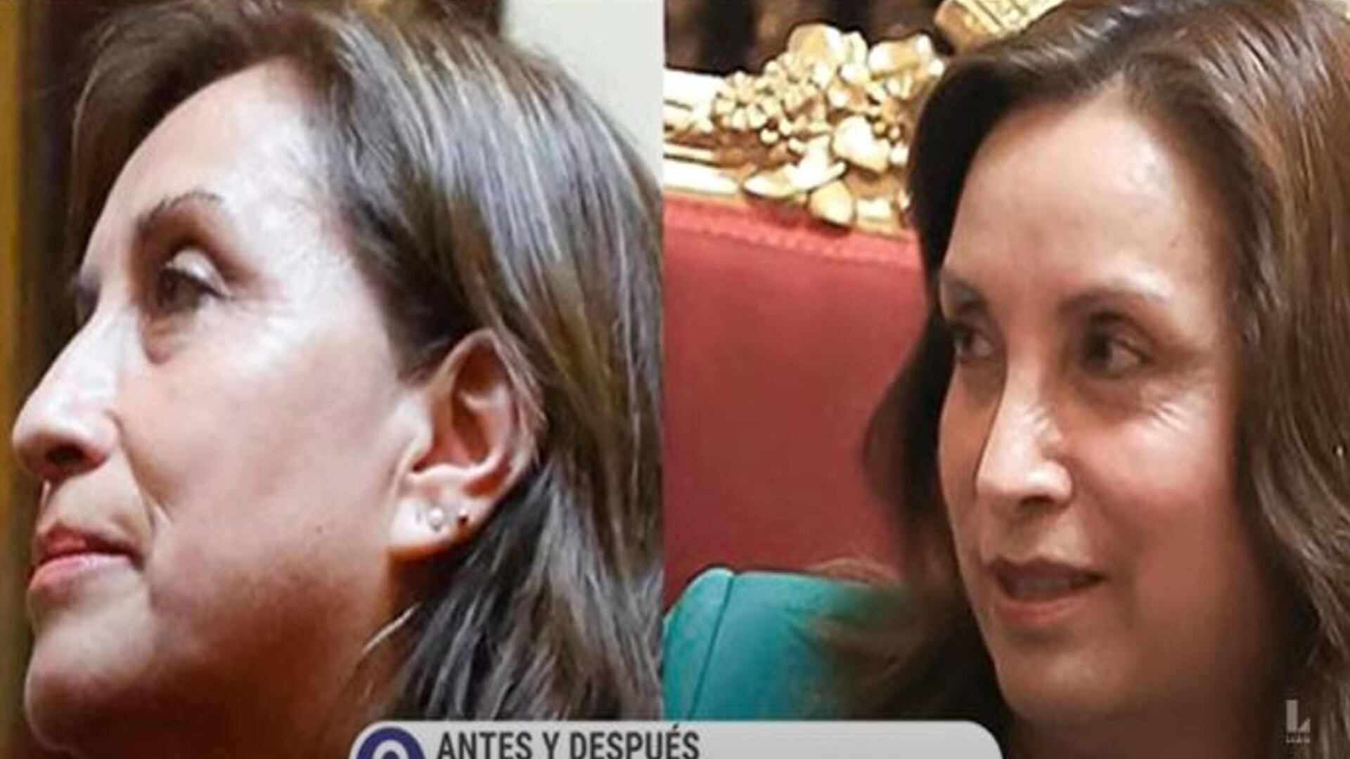 Dina Boluarte se sometió a cirugía en el rostro a mediados del 2023, lo que generó sospechas sobre sus firmas en normas de aquel entonces. Foto: captura TV