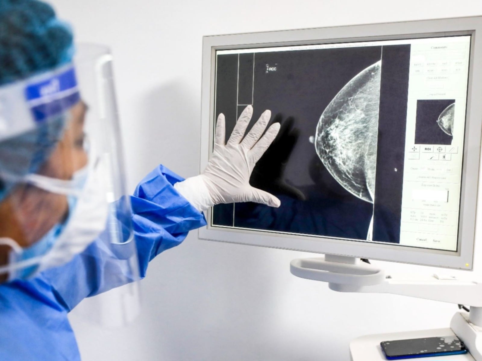 Detección de cáncer. (Foto: Difusión)