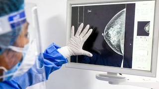 Minsa: detección de cáncer será gratuita solo con DNI en todos sus establecimientos