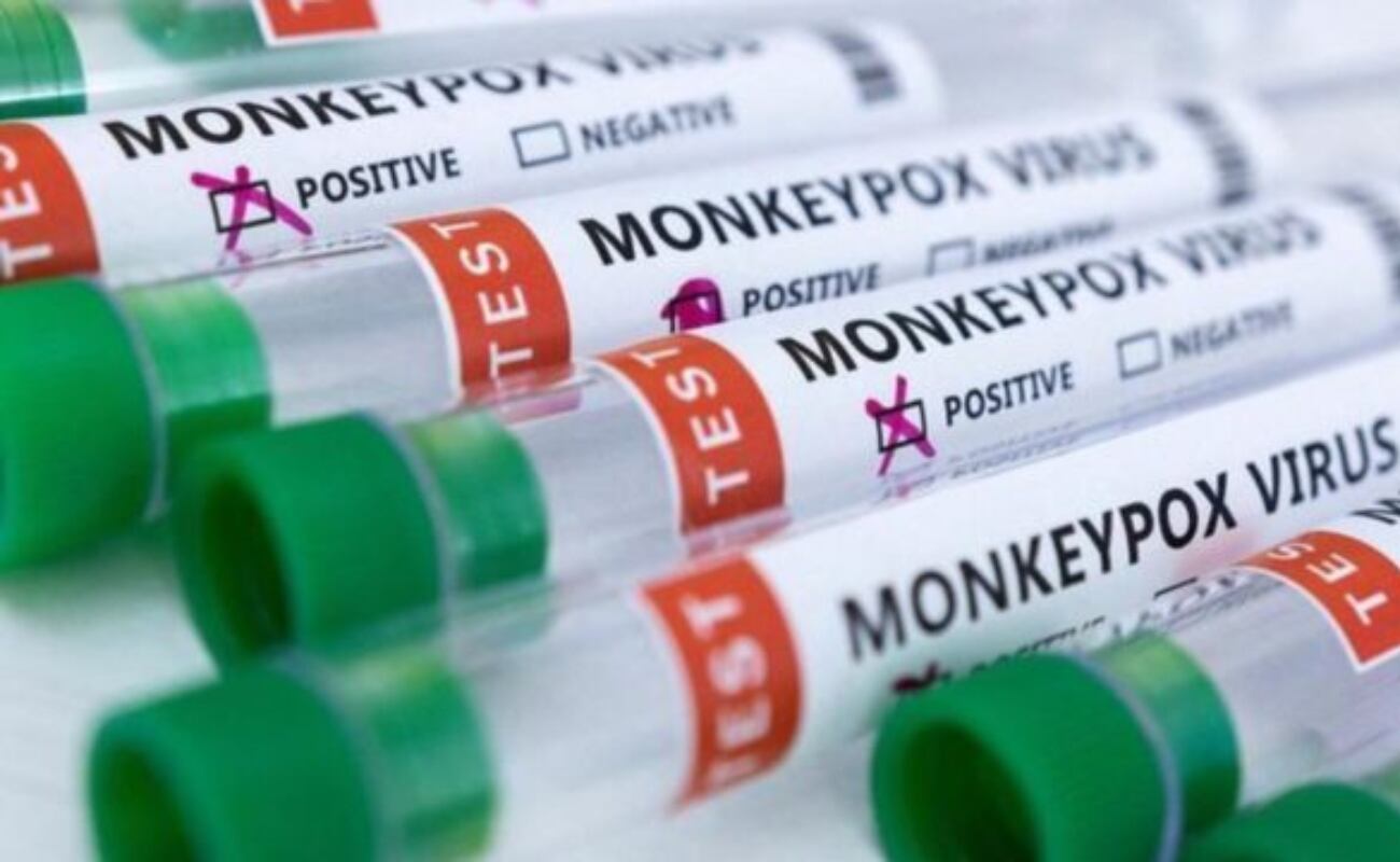 La situación en la República Democrática del Congo, donde una nueva cepa del virus se propaga desde setiembre, es especialmente alarmante.