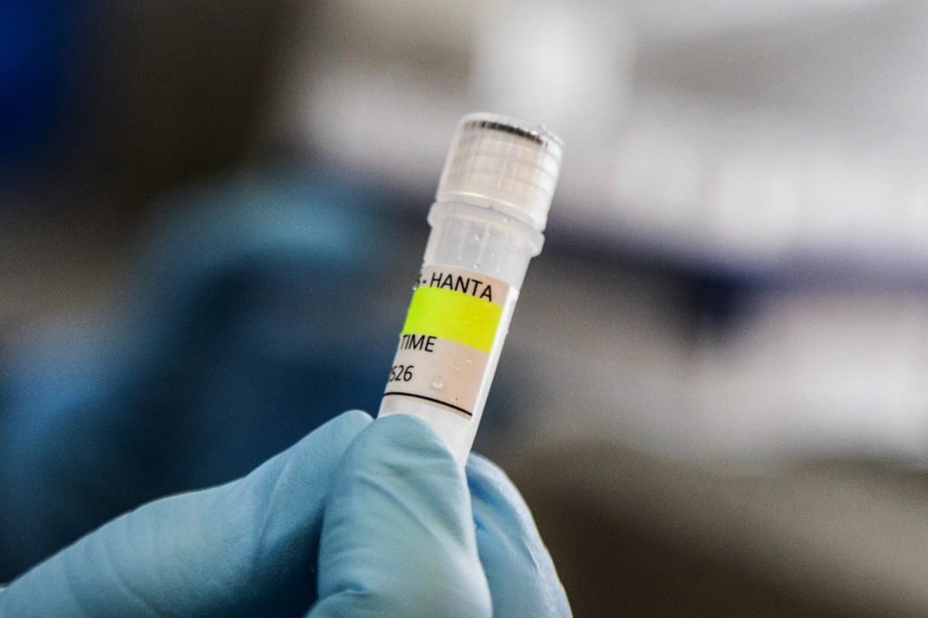 Esta fotografía, distribuida por el Ministerio de Salud de Argentina, muestra a un científico del Instituto Malbrín sosteniendo un recipiente utilizado para diagnosticar el hantavirus andino, que contiene ARN del virus como parte del proceso de detección, en Buenos Aires el 6 de mayo de 2026. (Foto: Distribución / MINISTERIO DE SALUD DE ARGENTINA / AFP)