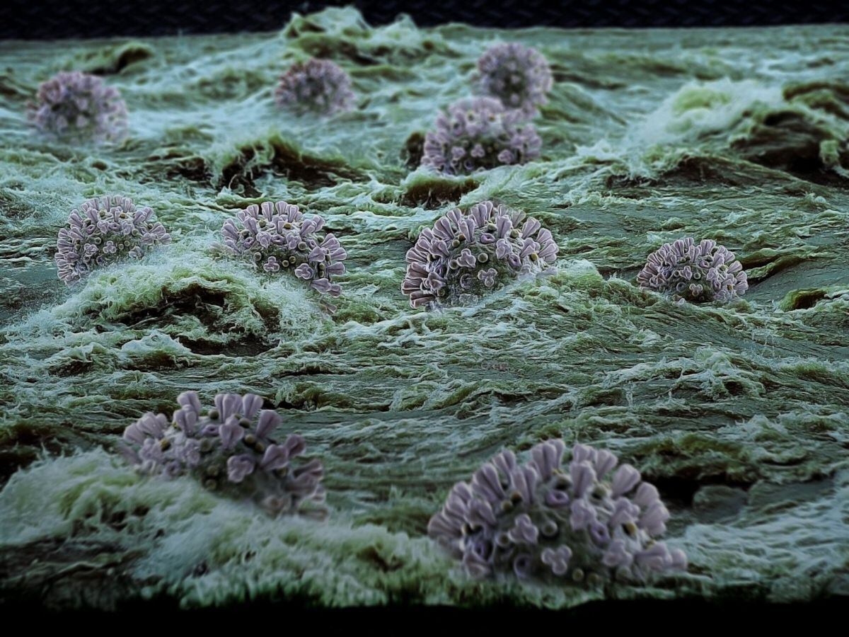 Hasta ahora, no hay evidencia de que las variantes emergentes estén asociadas con una enfermedad más grave o una reducción de la eficacia de la vacuna.