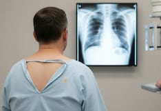 Confirman contagios de tuberculosis en la comunidad de dos escuelas en Nueva York: ¿qué se sabe al respecto?