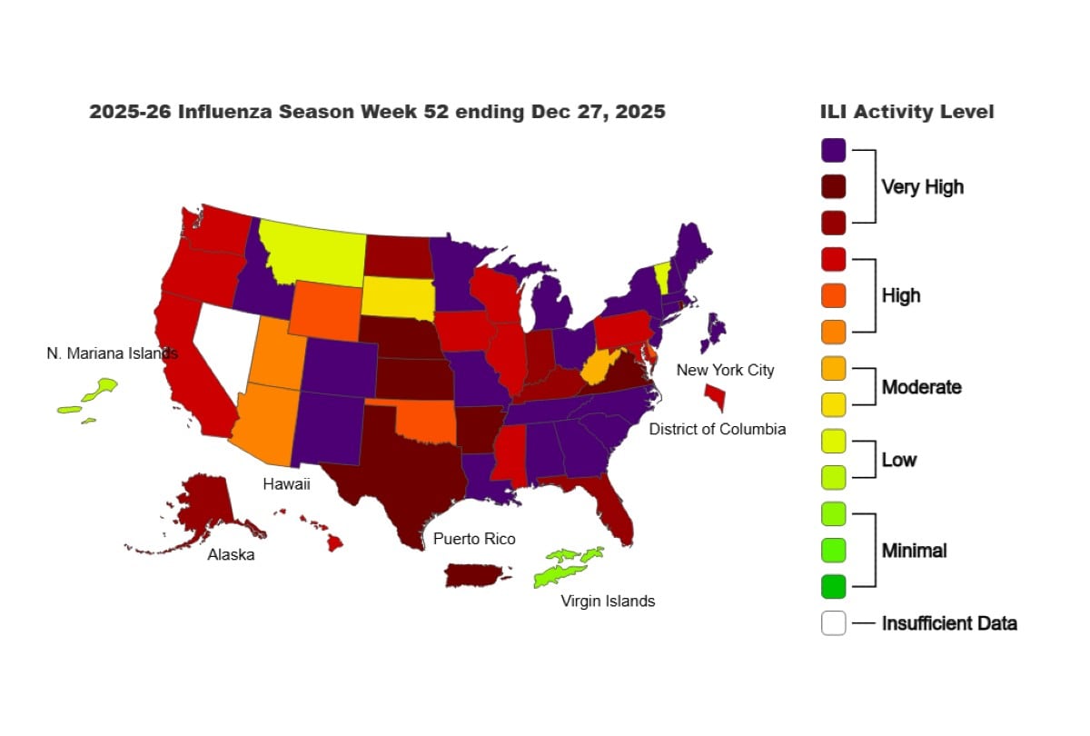 El mapa de contagios muestra que gran parte de EE.UU. concentra los niveles más altos de casos de gripe, con 45 estados en alerta sanitaria. | Crédito: CDC