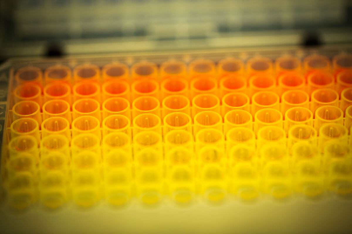 Las acciones de Intra-Cellular Therapies Inc. han subido un 40% en los últimos 12 meses. Fotógrafo: Carsten Snejbjerg/Bloomberg