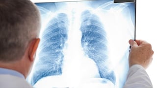 Hipertensión arterial pulmonar: Nueve de cada diez pacientes serían mujeres