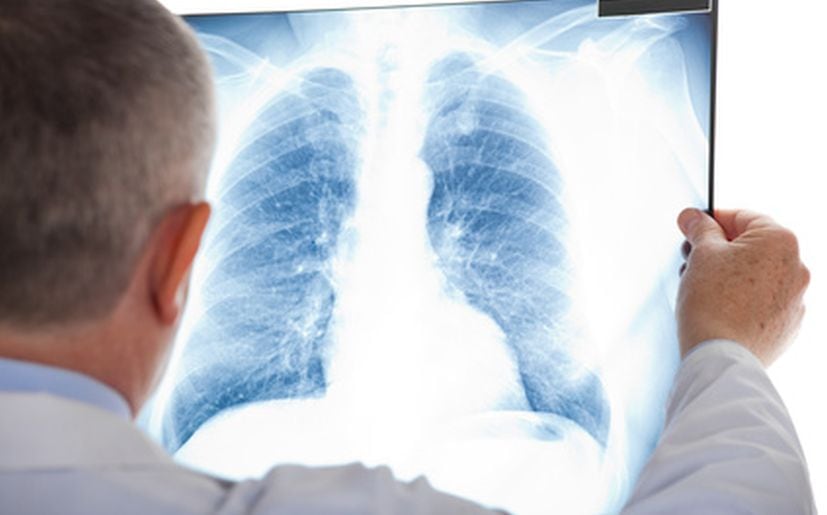 El nuevo listado de enfermedades huérfanas y raras del Ministerio de Salud incluirá Hipertensión arterial pulmonar. (Foto: USI)