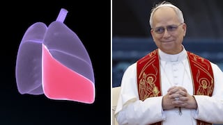 Médicos informan sobre la salud del Papa León XIV tras cirugía