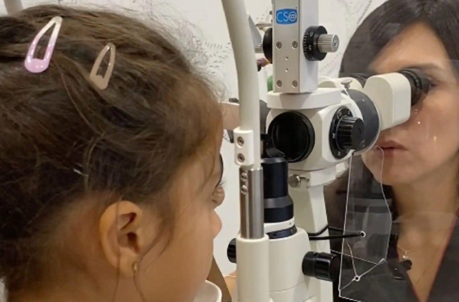 El estrabismo en niños puede provocar ambliopía u “ojo perezoso” si no se detecta y trata a tiempo.