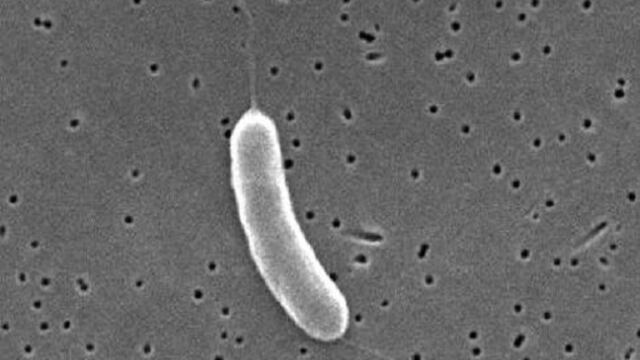 La bacteria más grande, visible al ojo, desafía principios de la biología