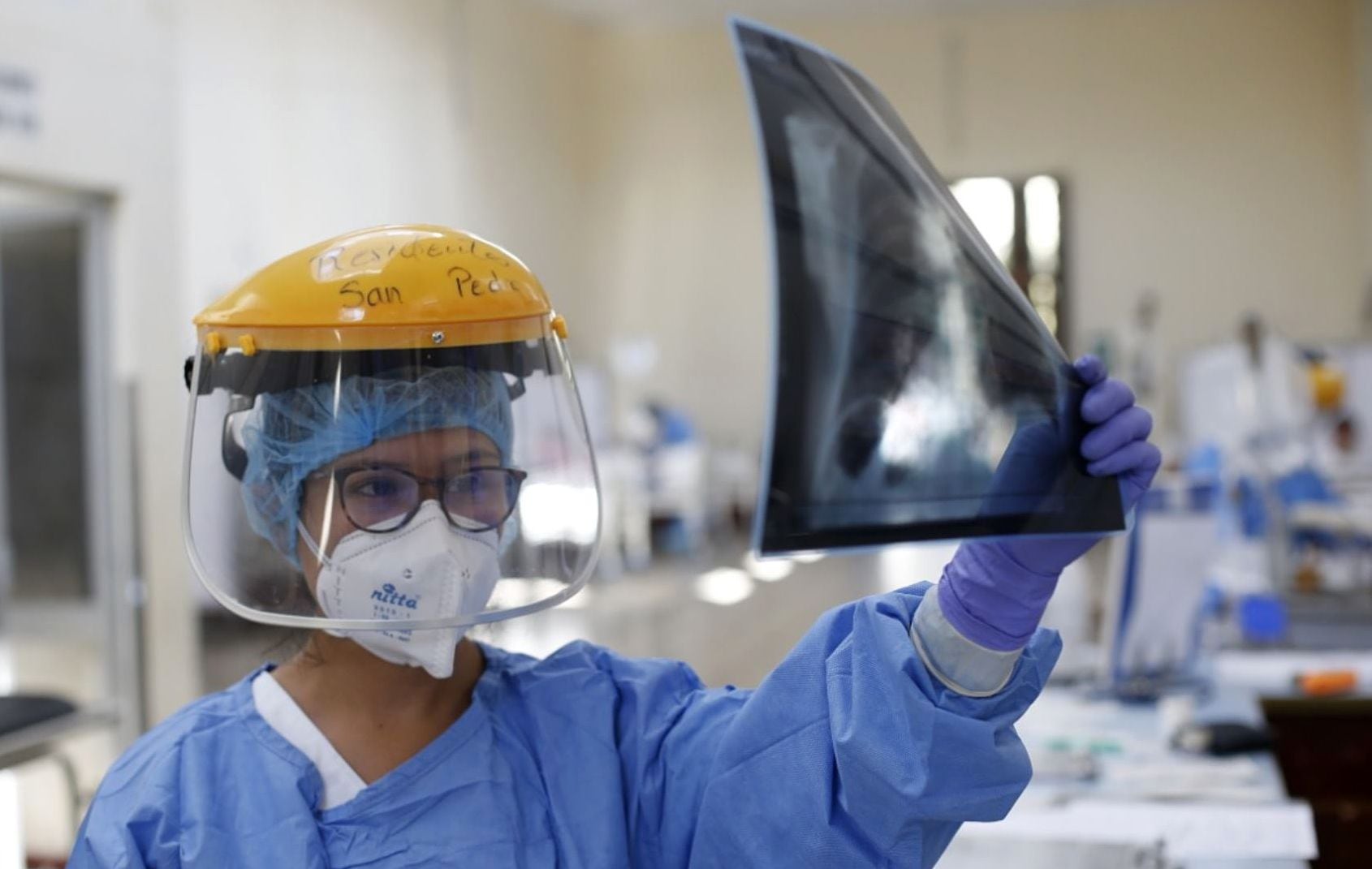 Una enfermera que mira la radiografía de los pulmones de Valerio Santa Cruz, de 90 años, que fue dado de alta del Hospital Estatal Dos de Mayo tras padecer de coronavirus. (Foto: Ministerio de Salud de Perú / AFP)