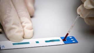 Un caso único de curación funcional del sida amplía las vías de investigación