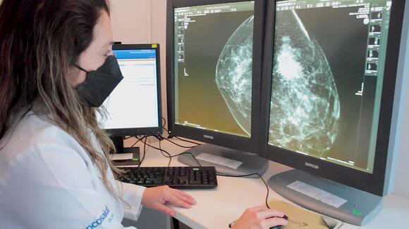 Día mundial contra el Cáncer de mama: Conoce la prevención y detección de esta neoplasia