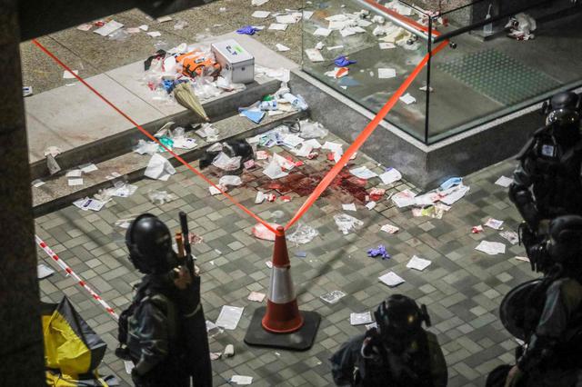 La emisora RTHK dijo que un concejal estaba entre los heridos y que una parte de su oreja había sido mordida. No fue posible verificar inmediatamente el reporte. (Foto: AFP)