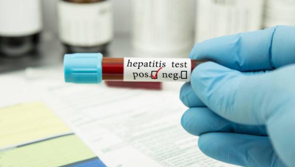 Conoce todo sobre esta hepatitis aguda que afecta a los niños y puede ser mortal (Foto: Getty Images)