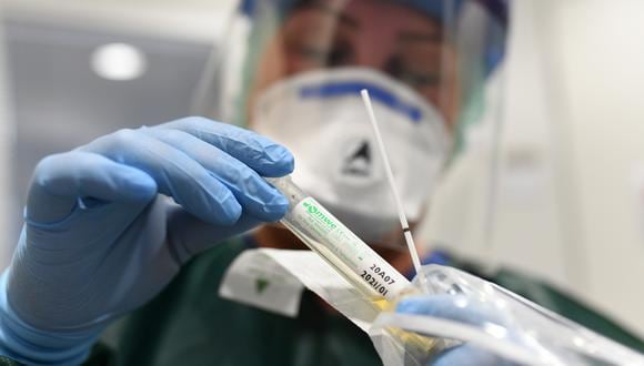 Está previsto repetir el test periódicamente para monitorizar el avance de la pandemia. (Foto: INA FASSBENDER / AFP)