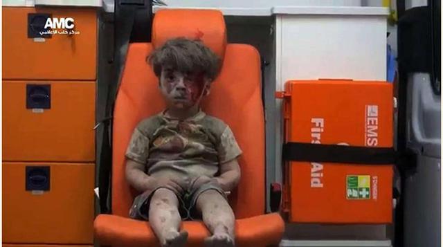 La imagen de este niño de cinco años, llamado Omran Daqneesh, es uno de los mayores impactos de la guerra de Siria.(foto:Diario ABC, S.L.)