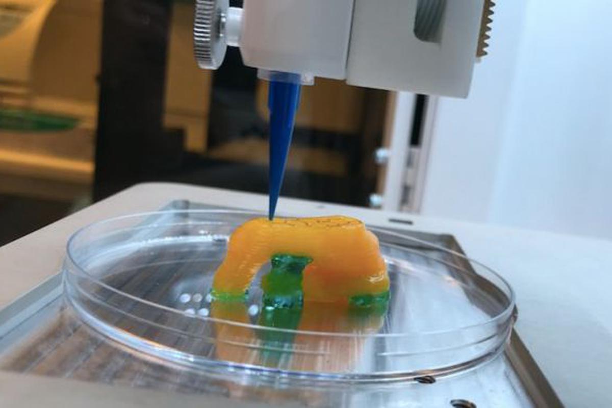 Pigmalión Dispensación Alegrarse Así funciona la impresora 3D que produce órganos en Suecia | TECNOLOGIA |  GESTIÓN