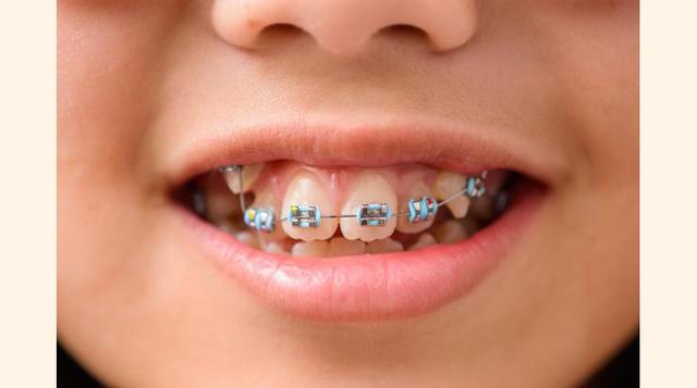 4.- Ortodoncistas. (foto: batanga).